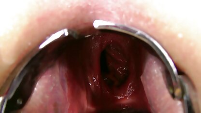 Kinkynikky Prolaps XO speculum شرجي سكس عربي مصري فقط